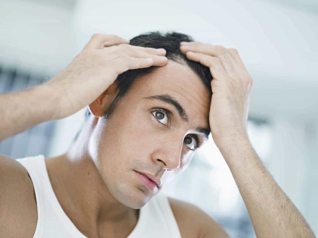 выпадение волос у мужчин